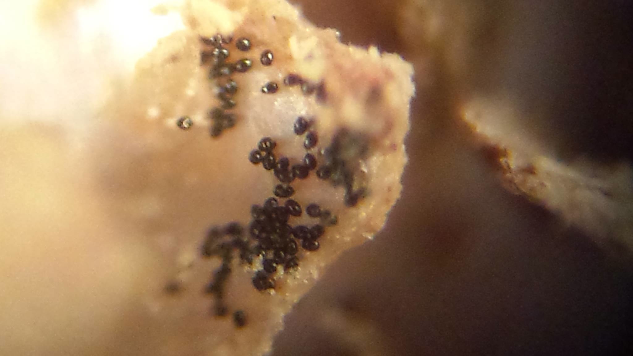 Black Pepper Specks In Stool